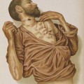 Hofmann_Lehrbuch_suicide_st